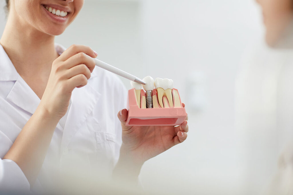 Knochenaufbau bietet Ihrem Zahnimplantat ein stabiles Fundament